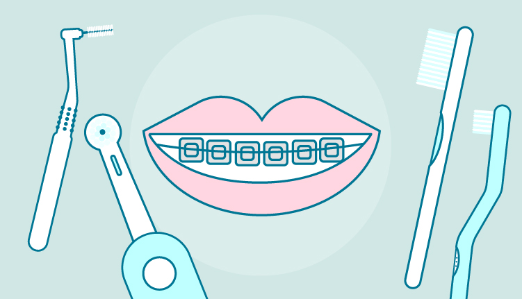 cepillo de dientes para ortodoncia